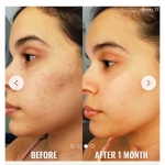 GOOD MOLECULES Glycolic  Exfoliating  Toner 120 ML – Image 4